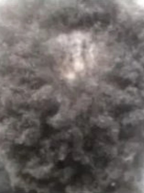 After — Hair regrowth results